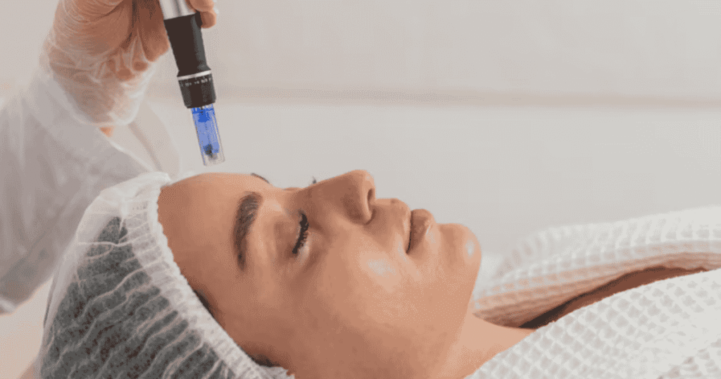 Microneedling & Mesotherapy in Manchester Nadia's Aesthetics Clinic